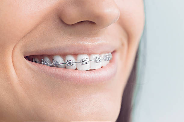 Best Teeth Whitening  in Inman, SC